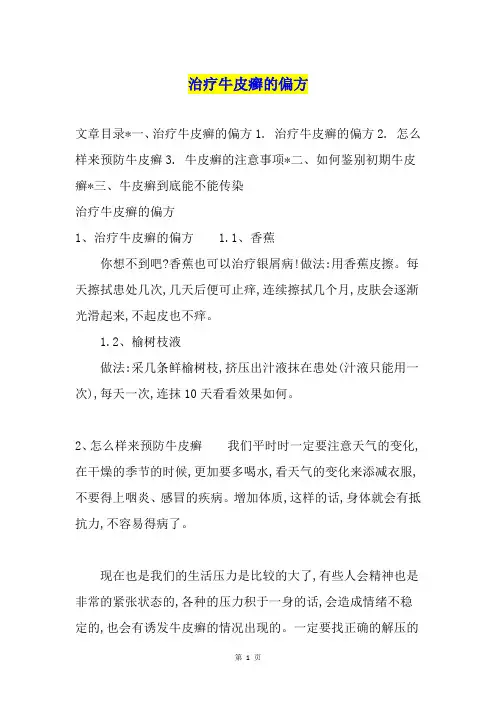 治疗牛皮癣的偏方