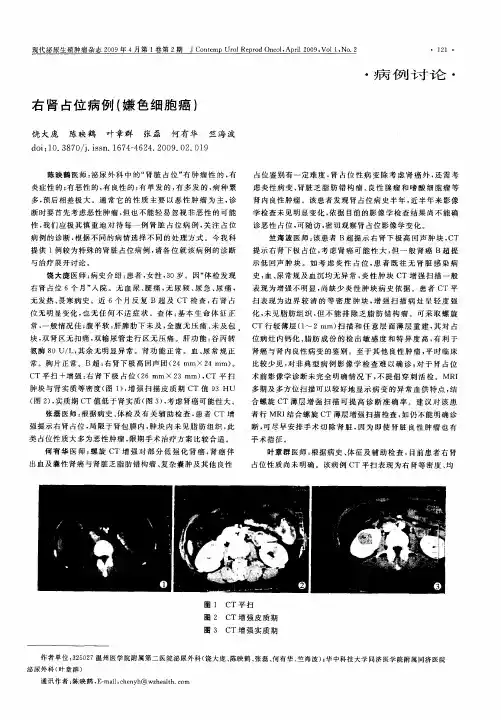 右肾占位病例(嫌色细胞癌)