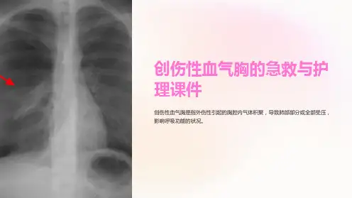 创伤性血气胸的急救与护理课件