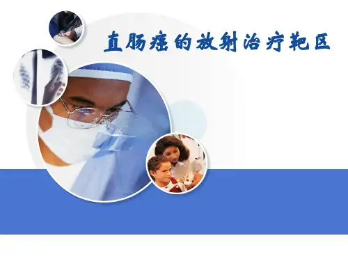 直肠癌的放射治疗靶区