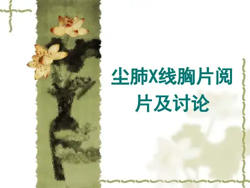 尘肺X线胸片阅片【89页】