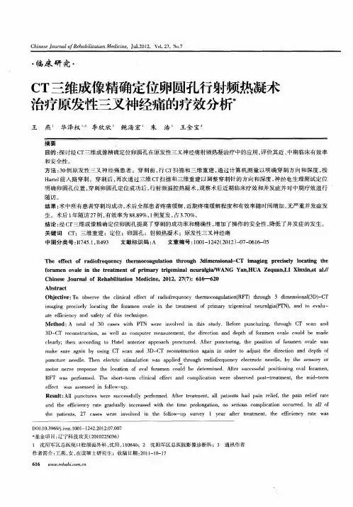 CT三维成像精确定位卵圆孔行射频热凝术治疗原发性三叉神经痛的疗效分析