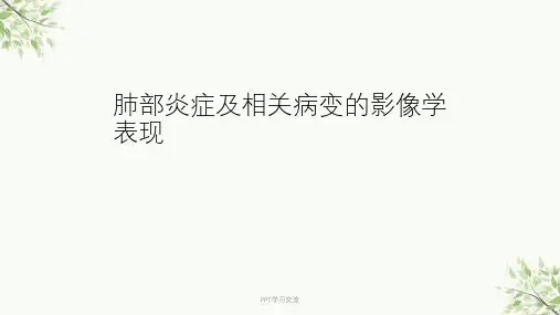 肺部炎症及相关病变的影像学表现课件