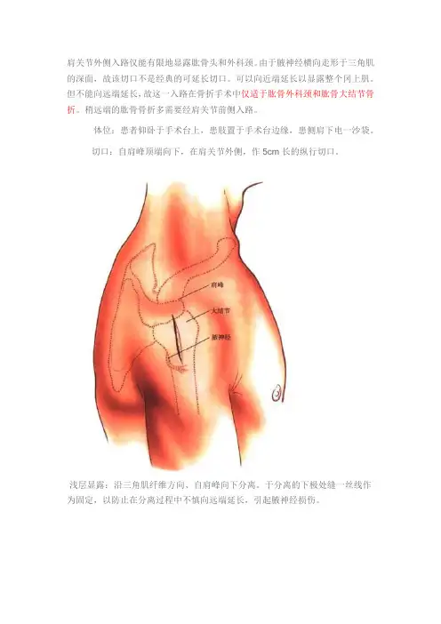 肩关节外侧入路