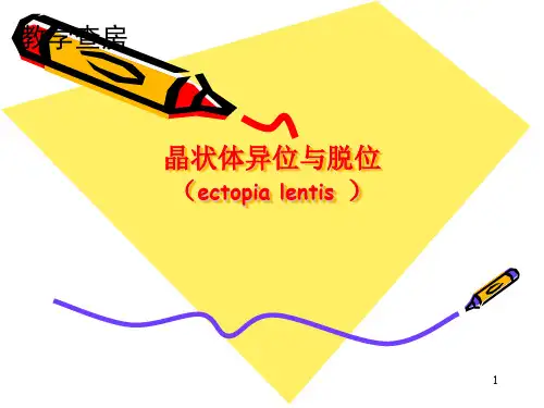 晶状体异位与脱位