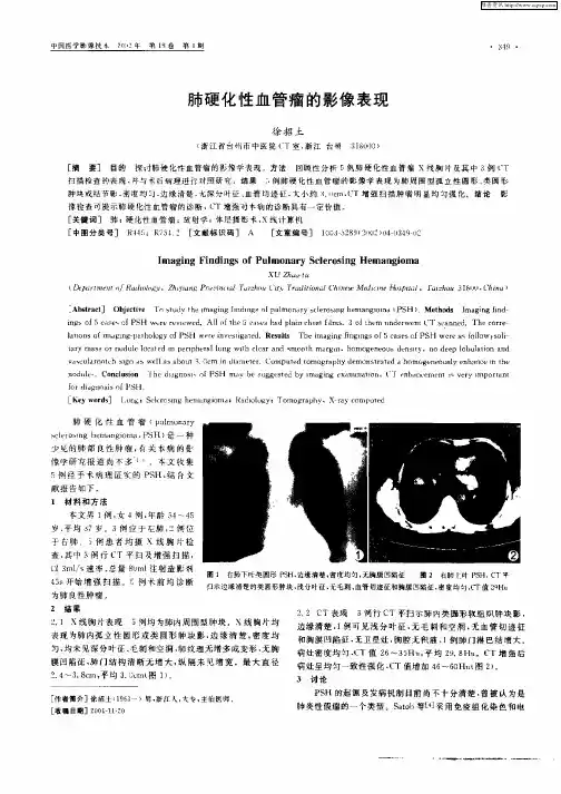 肺硬化性血管瘤的影像表现