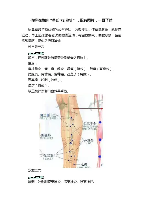 值得收藏的“董氏72绝针”，配有图片，一目了然
