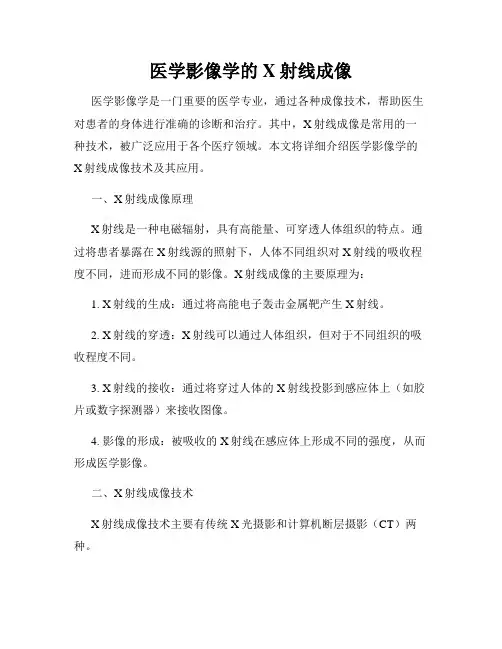 医学影像学的X射线成像