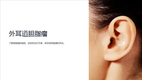 《外耳道胆脂瘤》课件 (2)