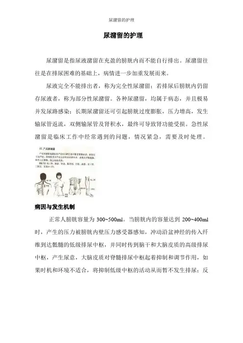 尿潴留的护理