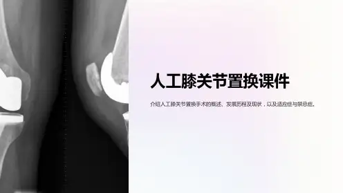 人工膝关节置换课件