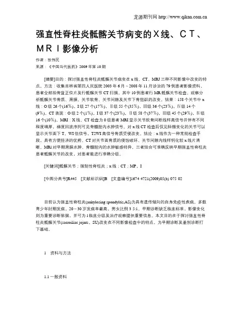 强直性脊柱炎骶髂关节病变的X线、CT、MRI影像分析