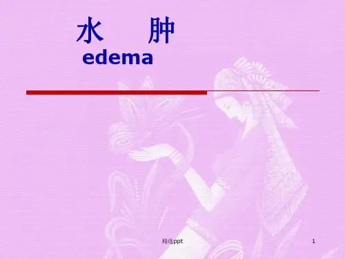 诊断学水肿