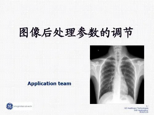 图像后处理参数调节