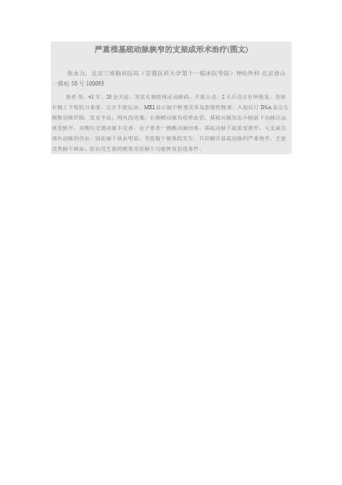 严重椎基底动脉狭窄的支架成形术治疗(图文)