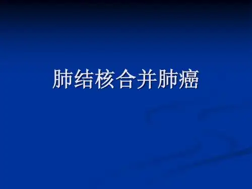 肺结核与肺癌