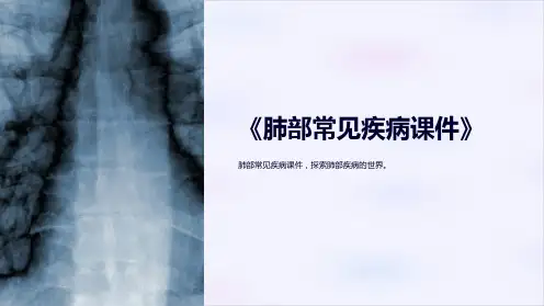 《肺部常见疾病课件》