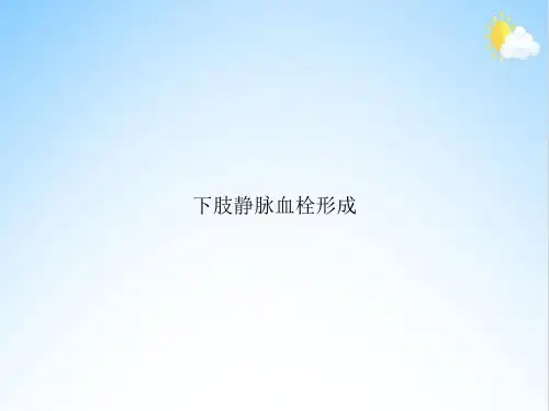 下肢静脉血栓形成