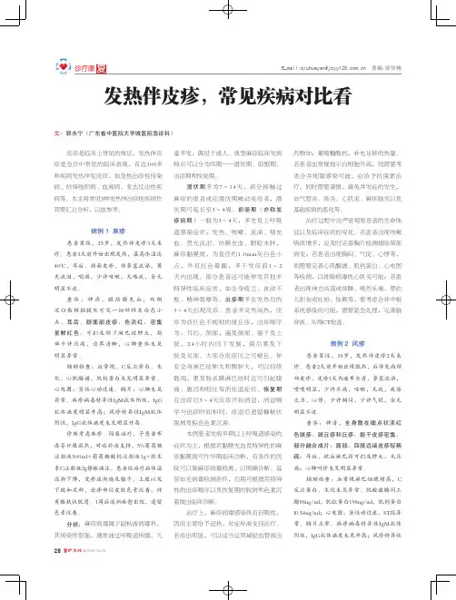 发热伴皮疹,常见疾病对比看