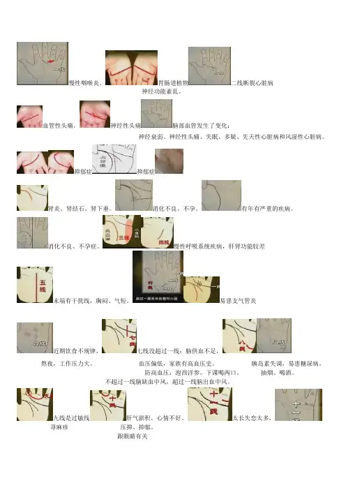 手诊病例图谱