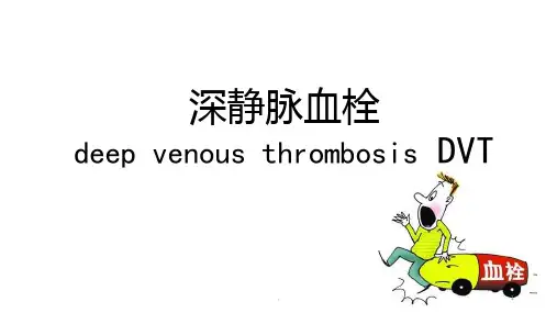 《深静脉血栓》PPT课件