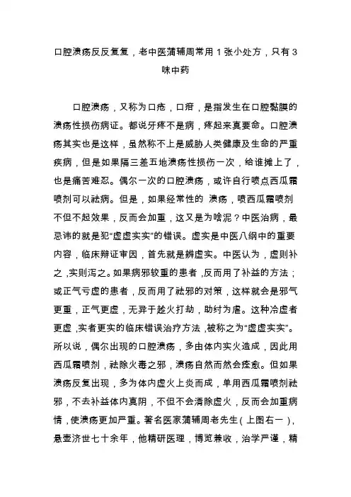 口腔溃疡反反复复,老中医蒲辅周常用1张小处方,只有3味中药