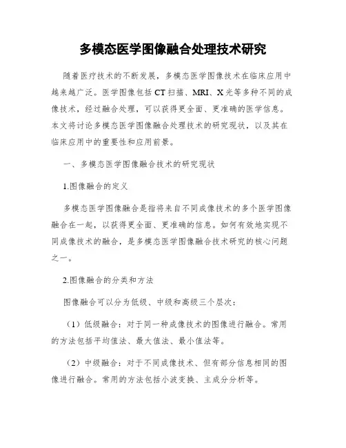 多模态医学图像融合处理技术研究