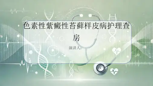 色素性紫癜性苔藓样皮病护理查房课件