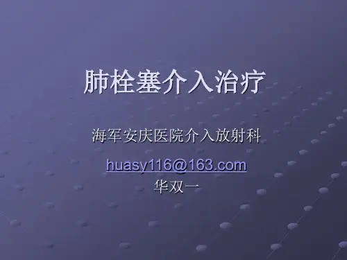 肺栓塞介入治疗