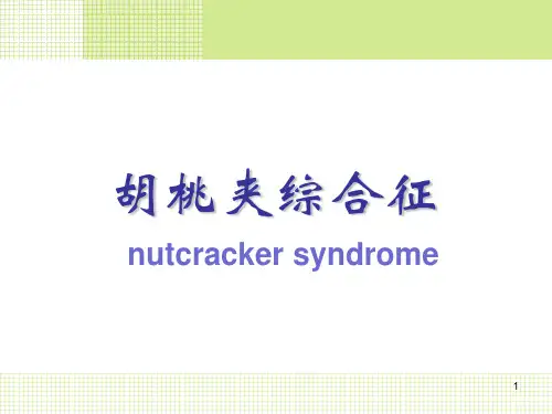 胡桃夹综合征ppt课件