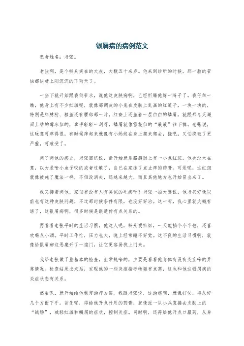 银屑病的病例范文