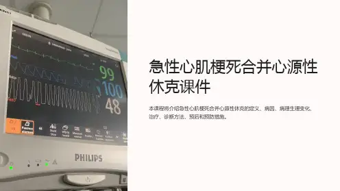 急性心肌梗死合并心源性休克课件