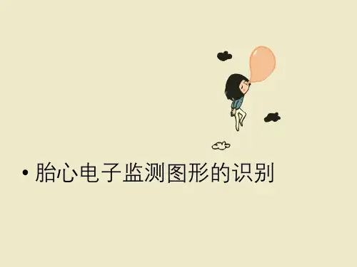 胎心监护课件