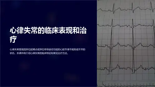 【内科学课件】心律失常的临床表现和治疗