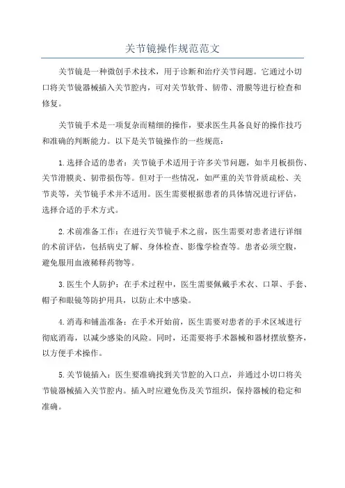 关节镜操作规范范文