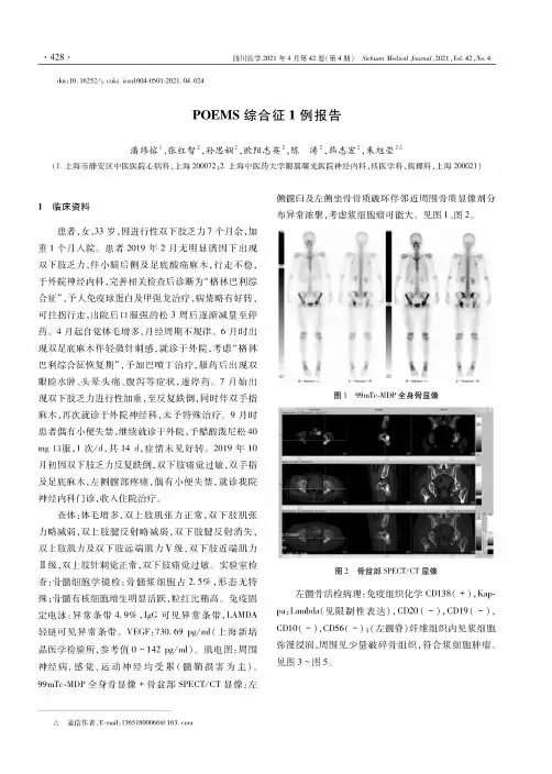 POEMS综合征1例报告