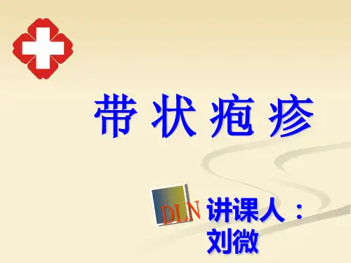 带状疱疹健康宣教