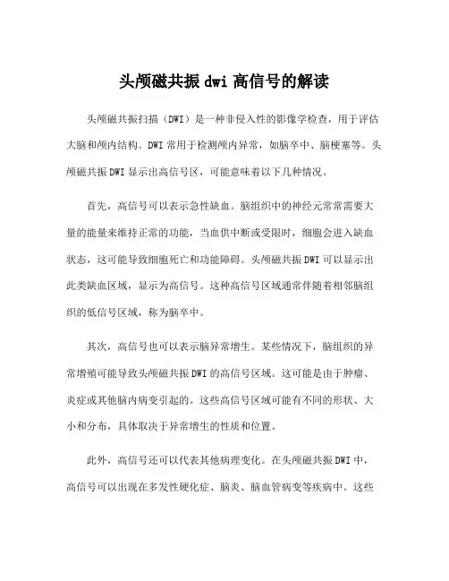 头颅磁共振dwi高信号的解读