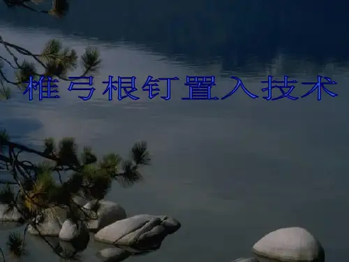 椎弓根钉置入技术讲座PPT课件