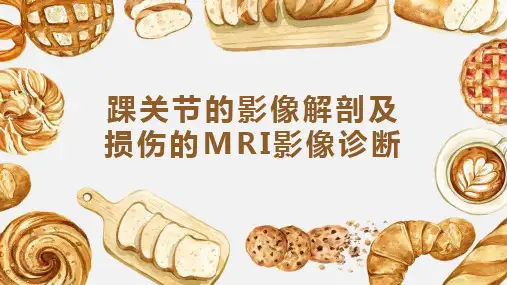 踝关节的影像解剖及损伤的MRI影像诊断