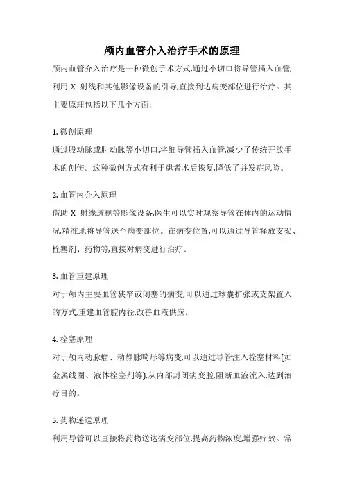 颅内血管介入治疗手术的原理