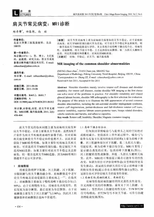 肩关节常见病变：MRI诊断