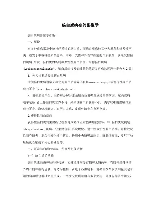 脑白质病变的影像学