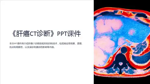 《肝癌CT诊断》课件