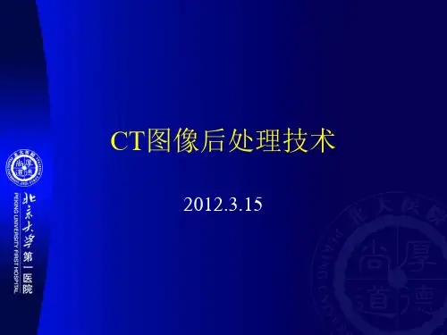 CT图像后处理技术