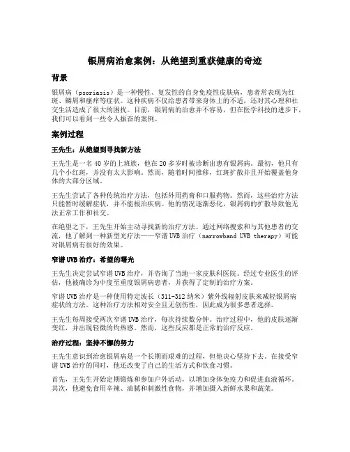 银屑病治好的案例