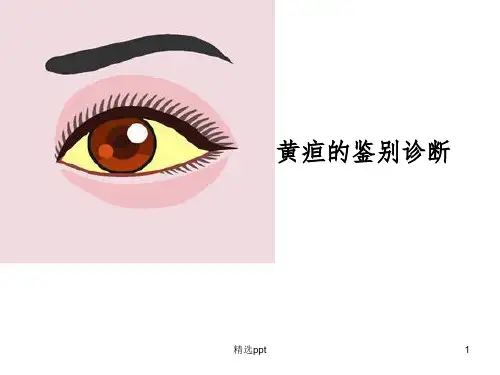 黄疸的鉴别诊断(1)