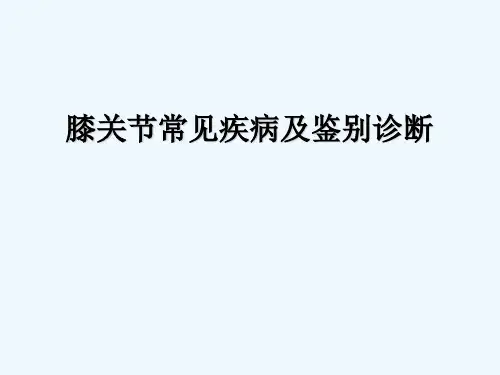 膝关节常见疾病及鉴别诊断 PPT