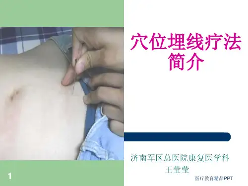 穴位埋线疗法