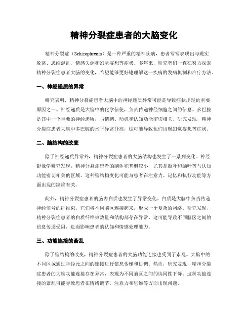 精神分裂症患者的大脑变化
